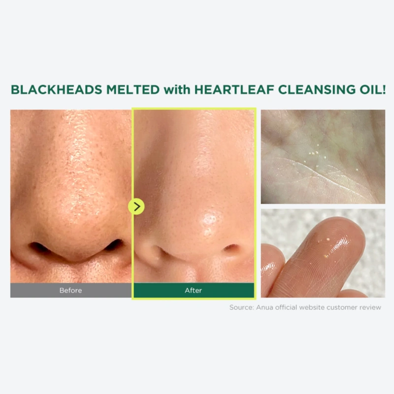 Anua heartleaf pore control cleansing oil 200ml-null