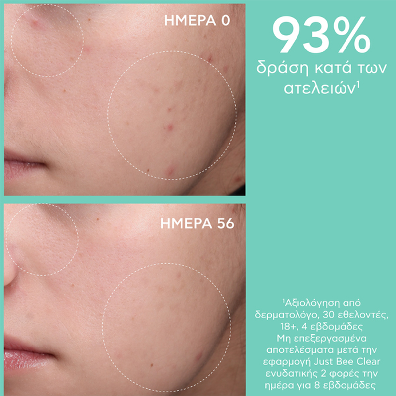 Apivita just bee clear blemish control mattifying moisturizer 40ml-null