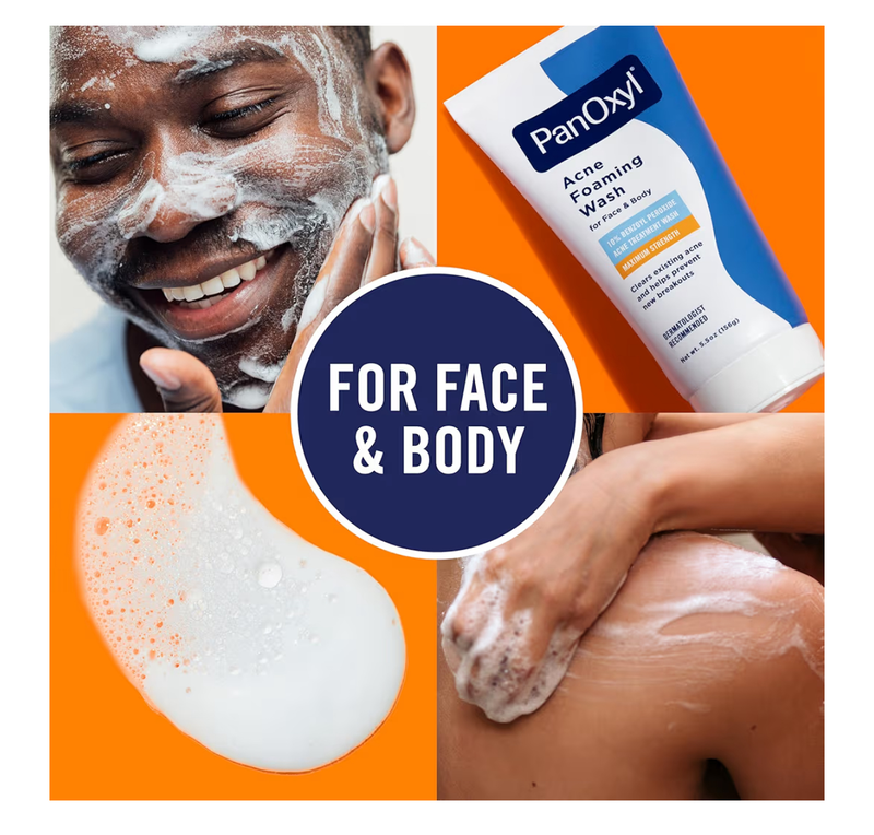 Panoxyl acne foaming wash benzoyl peroxide 10% maximum strength-null