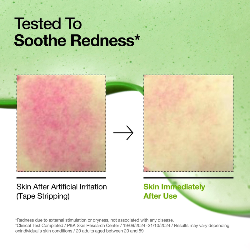 Anua azelaic acid 10% + hyaluron redness soothing serum 30ml, , medium-null