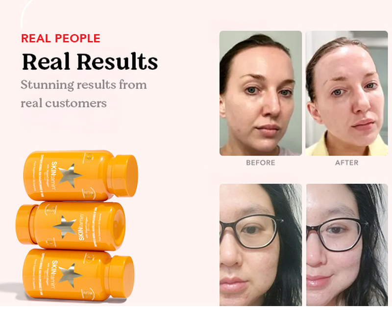 Hairtamin skintamin w/ veggiecollagen, , medium-null