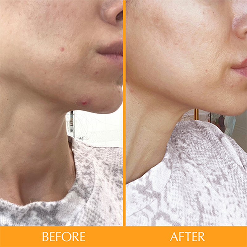 Product image: Skintamin - 1 bottle | skin health & collagen support, , medium-null
