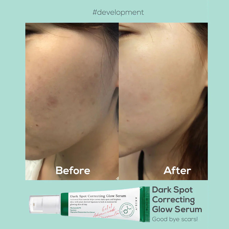 Axis-y dark spot correcting glow serum corrects & brightens 50 ml-null