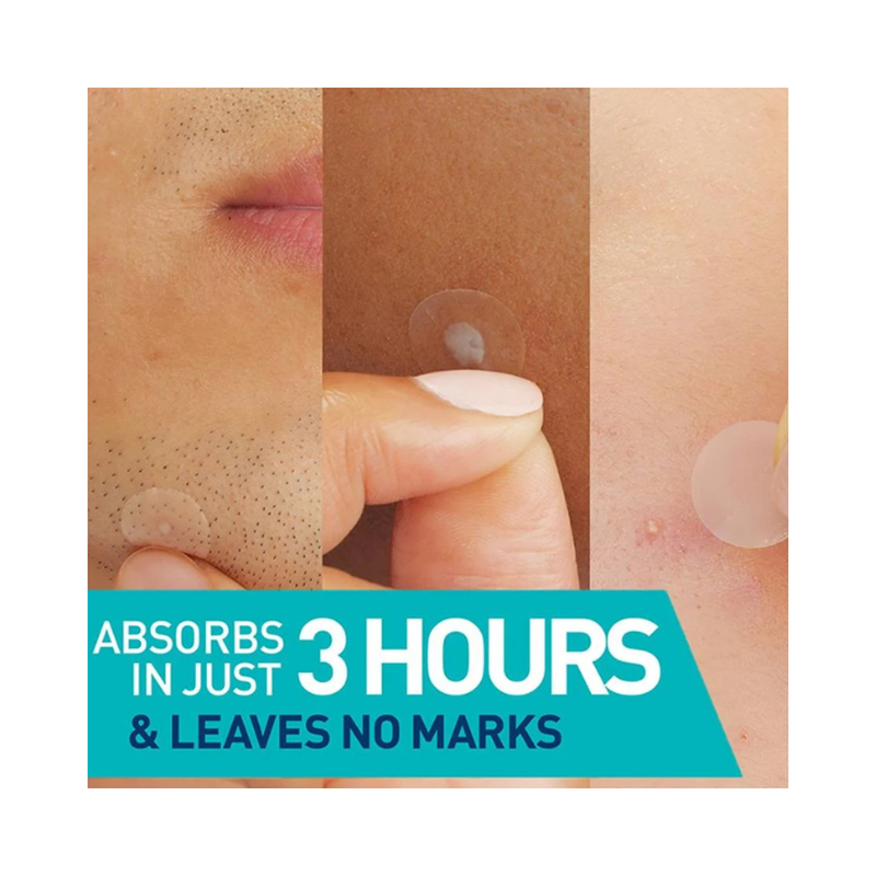 Cerave blemish barrier patches 22pcs, , medium-null