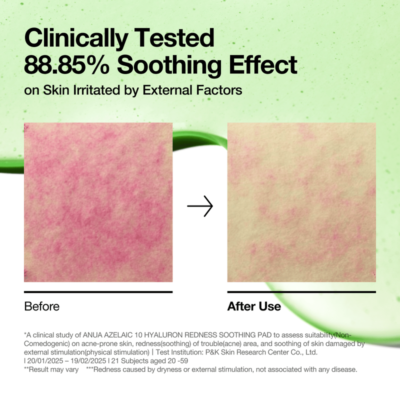 Anua azelaic 10 hyaluron redness soothing pad 90ea 230ml, , medium-null