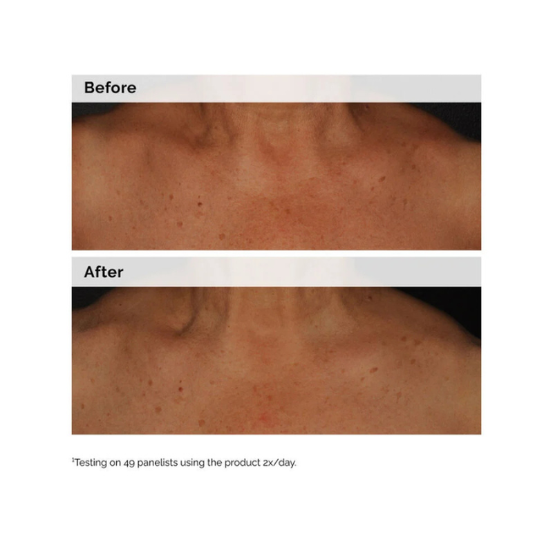 The ordinary niacinamide 5% face and body emulsion 100ml, , medium-null