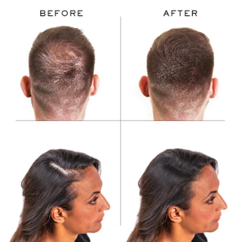 Product image: Nanogen keratin hair fibres (dark brown 04) 15gr-null