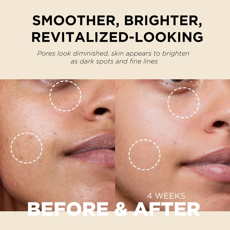 Retinoidin cream, , medium-null