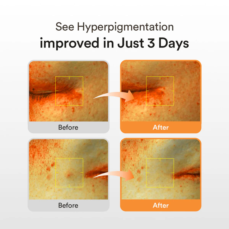 Abib glutathiosome dark spot serum vita drop 50ml, , medium-null