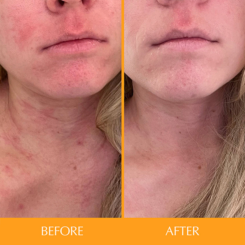 Product image: Skintamin - 1 bottle | skin health & collagen support, , medium-null