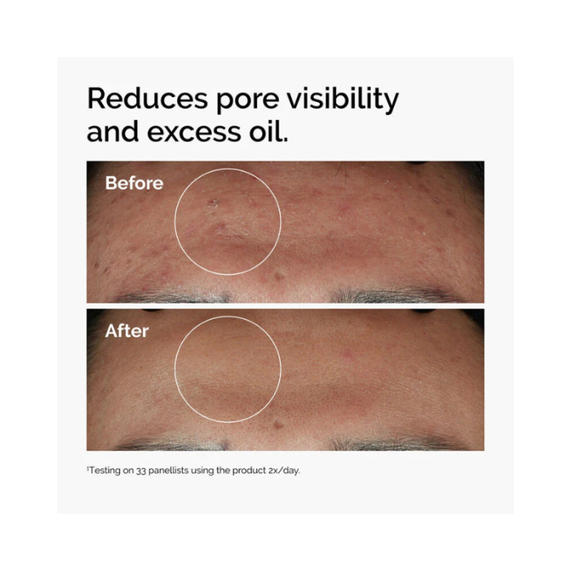 The ordinary niacinamide 10% + zinc 1%-null