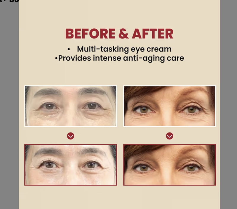 Ksecret seoul 1988 eye cream : retinal liposome 4% + fermented bean, wrinkle care, anti-aging, skin elasticity, pigmentation, retinol-null