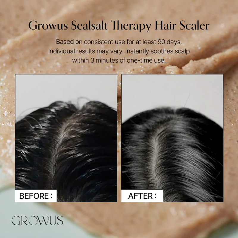 Sea salt therapy scalp scaler, , medium-null