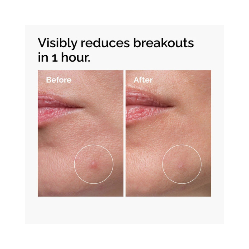 The ordinary sulfur 10% powder-to-cream concentrate 5g, , medium-null