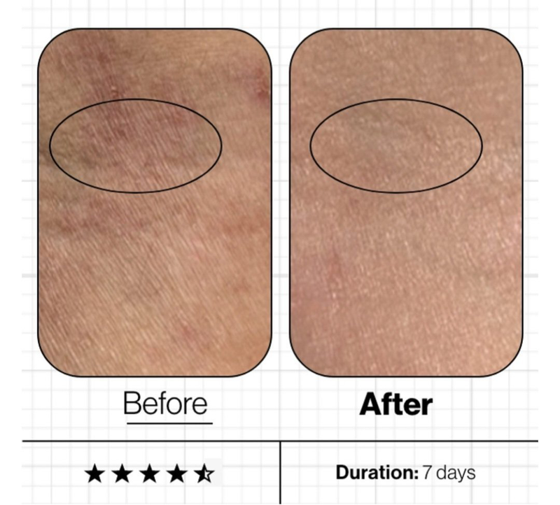 Skin moisture iq (new & improved), , medium-null