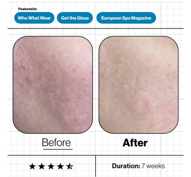Skin moisture iq (new & improved), , medium-null